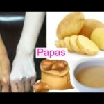 Cómo mejorar la preparación de papas con piel de elefante