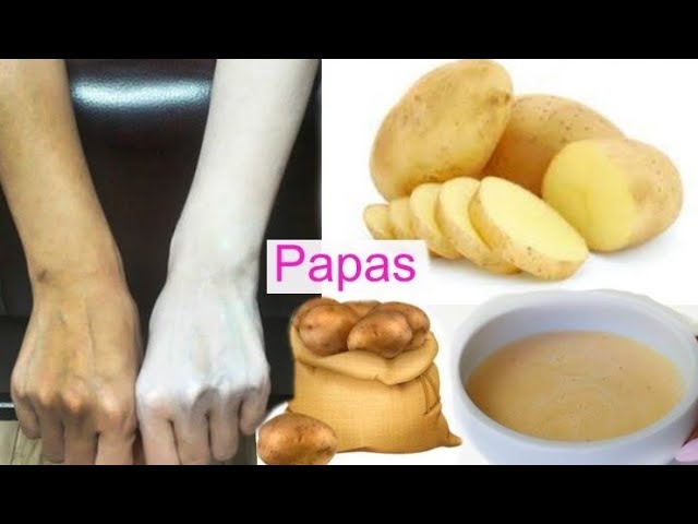 Cómo mejorar la preparación de papas con piel de elefante